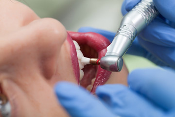 When to Contact an Emergency Dentist